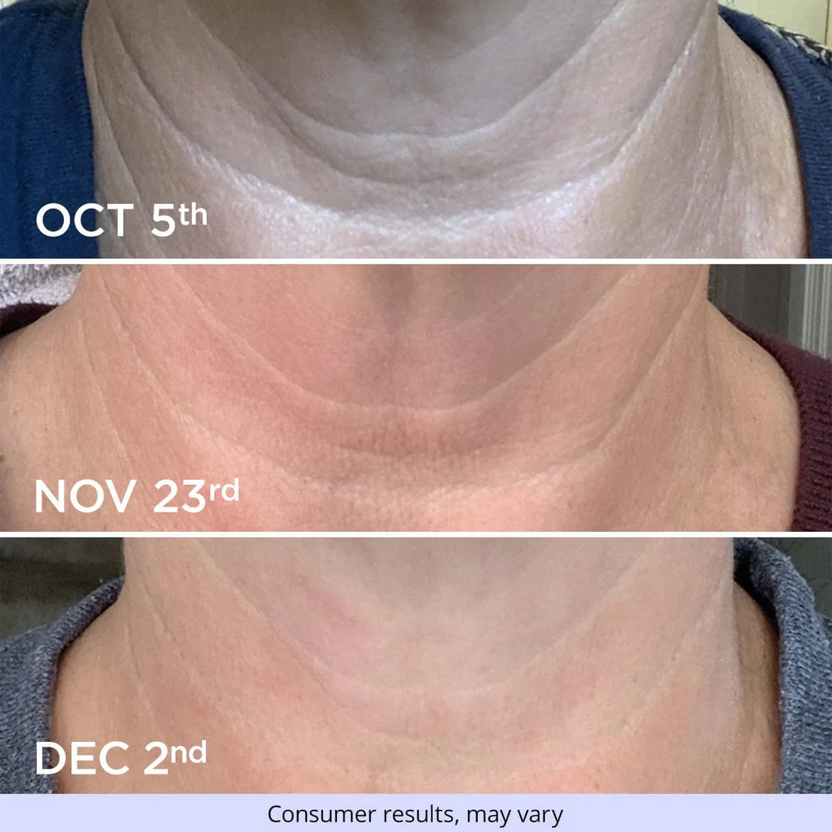 goPure Neck Tightening & Firming Cream | Anti-Aging Neck Cream for Tightening and Wrinkles for an Even Skin Tone and Neck Lift - With Pro-Active Firming Complex 1.7 oz