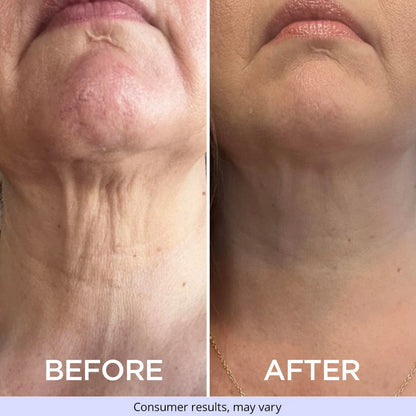 goPure Neck Tightening & Firming Cream | Anti-Aging Neck Cream for Tightening and Wrinkles for an Even Skin Tone and Neck Lift - With Pro-Active Firming Complex 1.7 oz