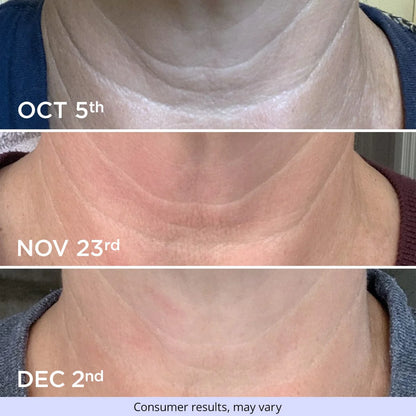 goPure Neck Tightening & Firming Cream | Anti-Aging Neck Cream for Tightening and Wrinkles for an Even Skin Tone and Neck Lift - With Pro-Active Firming Complex 1.7 oz